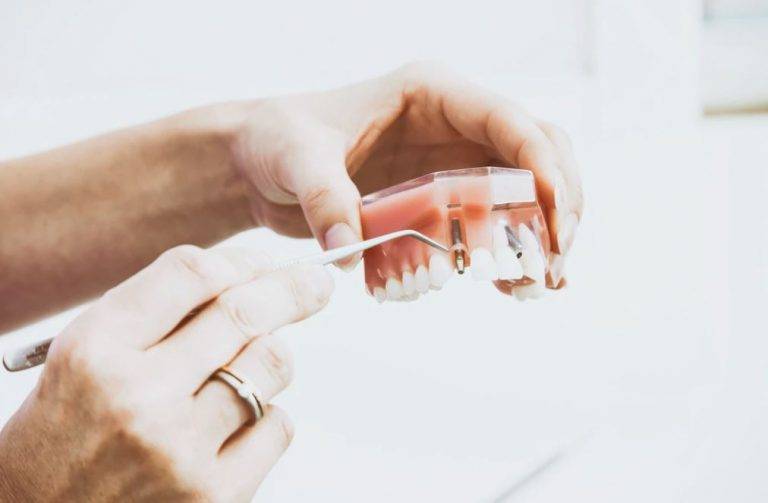 Dental Implant Mornington Peninsula